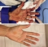 Ужасяваща снимка: Вижте как е изглеждала ръката на Квитова след нападението